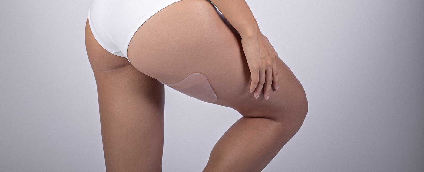 woman showing leg with SilcSkin pad